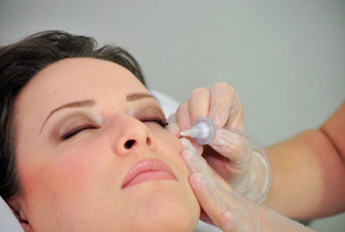 carboxiterapia facial frailebasanta
